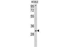 Western blot analysis of SOD3 Antibody (N-term) in K562 cell line lysates (35ug/lane). (SOD3 Antikörper  (N-Term))