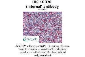 Image no. 2 for anti-CD70 Molecule (CD70) (Internal Region) antibody (ABIN1732875) (CD70 Antikörper  (Internal Region))