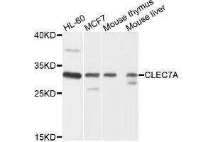 Western blot analysis of extracts of various cells, using CLEC7A antibody. (CLEC7A Antikörper)