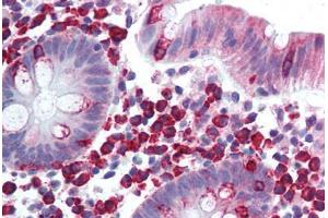 Colon, lamina propria plasma cells (LTK Antikörper  (AA 800-864))