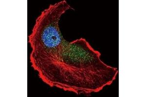 Immunofluorescence (IF) image for anti-Tuberous Sclerosis 2 (TSC2) (pSer1798) antibody (ABIN3029328)