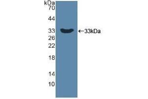 Detection of Recombinant DKK1, Human using Polyclonal Antibody to Dickkopf Related Protein 1 (DKK1) (DKK1 Antikörper  (AA 33-266))