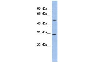 WB Suggested Anti-KCNIP2 Antibody Titration:  0. (KCNIP2 Antikörper  (Middle Region))