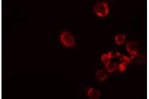 ABIN6278552 staining Hela cells by IF/ICC. (ARAF Antikörper  (Internal Region))