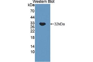 Western blot analysis of the recombinant protein. (TNXB Antikörper  (AA 3824-4071))