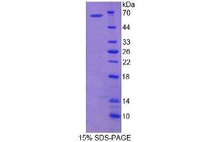 SDS-PAGE analysis of Mouse HRG Protein.