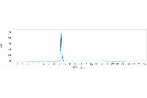 anti-Hepatitis B Virus Surface Antigen (HBsAg) antibody