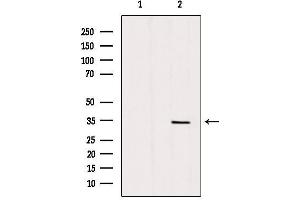 Western blot analysis of extracts from mouse brain, using SLC25A5 Antibody. (SLC25A5 Antikörper  (Internal Region))