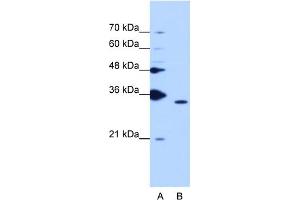 WB Suggested Anti-PPIE Antibody Titration:  1. (PPIE Antikörper  (Middle Region))