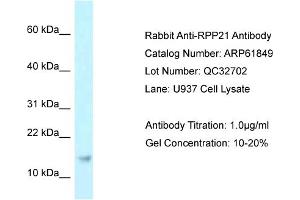 Western Blotting (WB) image for anti-Ribonuclease P/MRP 21kDa Subunit (RPP21) (Middle Region) antibody (ABIN2788924) (RPP21 Antikörper  (Middle Region))