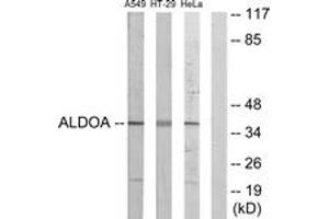 Western blot analysis of extracts from A549/HeLa/HT-29 cells, using ALDOA Antibody. (ALDOA Antikörper  (AA 1-50))