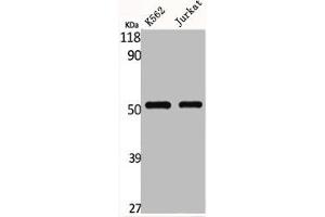 Western Blot analysis of K562 Jurkat cells using Glut1 Polyclonal Antibody (GLUT1 Antikörper  (C-Term))