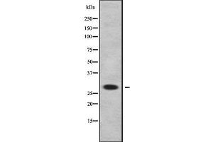 Western blot analysis of DHRS11 using Jurkat whole cell lysates (DHRS11 Antikörper  (Internal Region))