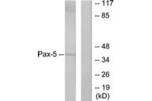 Western blot analysis of extracts from 293 cells, using Pax-5 Antibody. (PAX5 Antikörper  (AA 1-50))