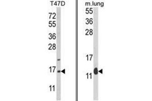 (LEFT) Western blot analysis of PEA-15 Antibody (C-term) in T47D cell line lysates (35ug/lane). (PEA15 Antikörper  (C-Term))
