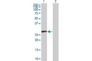 Western Blotting (WB) image for anti-Complement C1q Tumor Necrosis Factor-Related Protein 6 (C1QTNF6) (AA 32-278) antibody (ABIN530303)