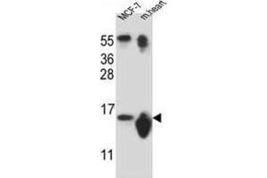 Western Blotting (WB) image for anti-Small Nuclear Ribonucleoprotein D3 Polypeptide 18kDa (SNRPD3) antibody (ABIN2912095) (SNRPD3 Antikörper)