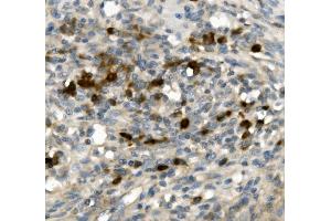 IHC analysis of GFI1 using anti-GFI1 antibody (ABIN7599380).