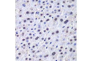 Immunohistochemistry of paraffin-embedded human liver injury using APEX1 antibody. (APEX1 Antikörper  (AA 1-318))