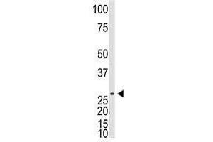 Image no. 1 for anti-Dickkopf-Like 1 (DKKL1) (C-Term) antibody (ABIN357076) (Dickkopf-Like 1 (DKKL1) (C-Term) Antikörper)