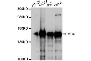 Western blot analysis of extracts of various cell lines, using SMC4 antibody. (SMC4 Antikörper)