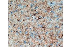 IHC-P analysis of brain tissue, with DAB staining. (S100B Antikörper  (AA 1-92))