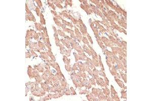 Immunohistochemistry (IHC) image for anti-Adrenoceptor alpha 1A (ADRA1A) (AA 346-475) antibody (ABIN1678588)