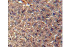 IHC-P analysis of Liver tissue, with DAB staining. (ITIH3 Antikörper  (AA 279-467))