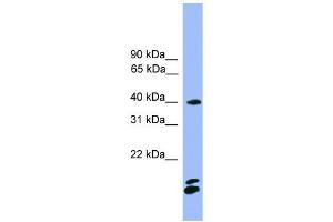 WB Suggested Anti-NFATC1 Antibody Titration: 0. (NFATC1 Antikörper  (N-Term))