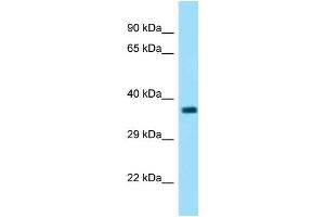 WB Suggested Anti-Fbxo2 Antibody   Titration: 1. (FBXO2 Antikörper  (C-Term))