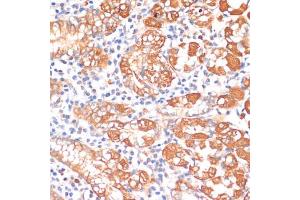 Immunohistochemistry of paraffin-embedded human stomach using HHL antibody (ABIN6132190, ABIN6141750, ABIN6141751 and ABIN6217197) at dilution of 1:100 (40x lens). (HHLA2 Antikörper  (AA 30-200))