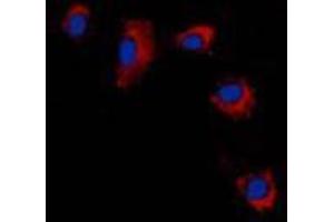 Immunofluorescent analysis of Claudin 2 staining in A431 cells. (Claudin 2 Antikörper  (C-Term))