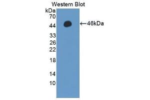 Western Blotting (WB) image for anti-Protein Phosphatase, Mg2+/Mn2+ Dependent, 1A (PPM1A) (AA 2-382) antibody (ABIN1869913)
