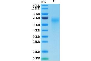 SDS-PAGE (SDS) image for Interleukin 2 Receptor, gamma (IL2RG) (AA 23-254) protein (His tag) (ABIN7274058)