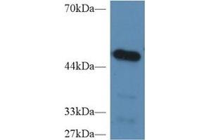 Detection of CPB2 in Mouse Heart lysate using Polyclonal Antibody to Carboxypeptidase B2 (CPB2) (CPB2 Antikörper  (AA 113-422))