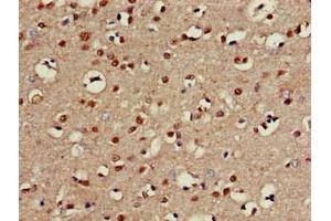 Immunohistochemistry of paraffin-embedded human brain tissue using ABIN7146672 at dilution of 1:100 (CHST1 Antikörper  (AA 305-397))