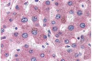 Human Liver (formalin-fixed, paraffin-embedded) stained with APOC1 antibody ABIN351488 at 3. (APOC1 Antikörper  (AA 70-83))