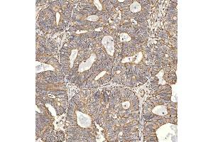 IHC analysis of TST using anti-TST antibody (ABIN7599105).
