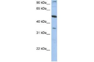 PLXDC1 antibody used at 1 ug/ml to detect target protein. (PLXDC1 Antikörper  (N-Term))