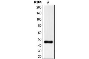 Western blot analysis of PHKG1 expression in A375 (A) whole cell lysates. (PHKG1 Antikörper  (Center))