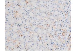 ABIN6256390 and ABIN6267486 at 1/200 staining Rat kidney tissue sections by IHC-P. (IRS1 Antikörper  (pSer639))