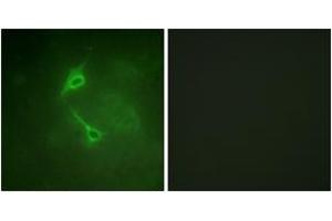 Immunofluorescence analysis of NIH-3T3 cells, using PKC zeta (Ab-560) Antibody. (PKC zeta Antikörper  (AA 526-575))