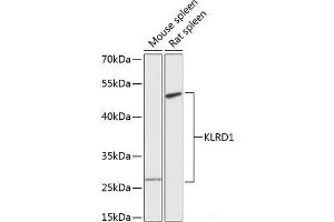 Western blot analysis of extracts of various cell lines using KLRD1 Polyclonal Antibody at dilution of 1:3000. (CD94 Antikörper)
