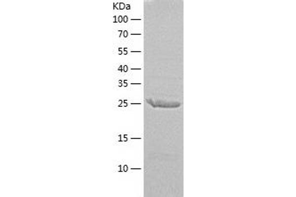 EXOSC7 Protein (AA 1-291) (His tag)