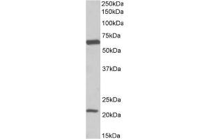 Staining of Human Frontal Cortex lysate using SLC1A3 / EAAT1 antibody at 0. (SLC1A3 Antikörper  (Internal Region))