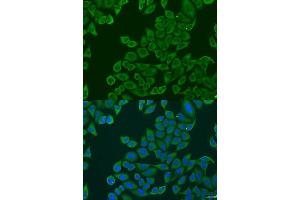 Immunofluorescence analysis of U2OS cells using RPL36 antibody. (RPL36 Antikörper  (AA 1-105))