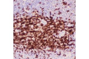 Immunohistochemistry (IHC) image for anti-CD3 epsilon (CD3E) (AA 23-207) antibody (ABIN3043805)