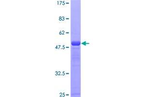 Image no. 1 for Sjogren Syndrome/scleroderma Autoantigen 1 (SSSCA1) (AA 1-199) protein (GST tag) (ABIN1321430) (SSSCA1 Protein (AA 1-199) (GST tag))