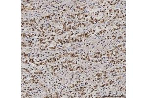 IHC analysis of PC4/SUB1 using anti-PC4/SUB1 antibody (ABIN7602185). (SUB1 Antikörper  (AA 62-127))