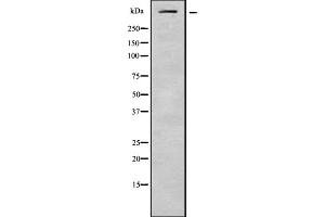 Western blot analysis of ASPM using HeLa whole cell lysates (ASPM Antikörper  (Internal Region))